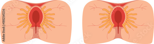 Anatomical Illustration of Human Breast Mammary Gland Structure Showing Milk Ducts and Lobules for Medical Education Healthcare and Women Health Science