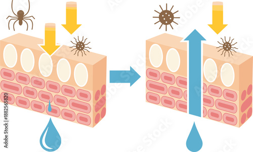 Comparison diagram of healthy skin versus damaged skin barrier showing moisture loss and penetration of dust mites bacteria and allergens