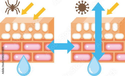 Illustration of healthy skin versus damaged skin barrier showing protection against allergens bacteria and moisture loss with arrows and water drops