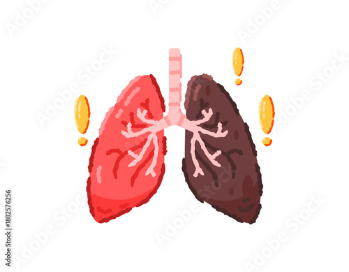 Illustration of a lung organ with one side unhealthy. Lung disease. Infection, cancer, TB or tuberculosis, pneumonia. Health problems. Respiratory organs. Smoker's lungs. Flat style outline crayon