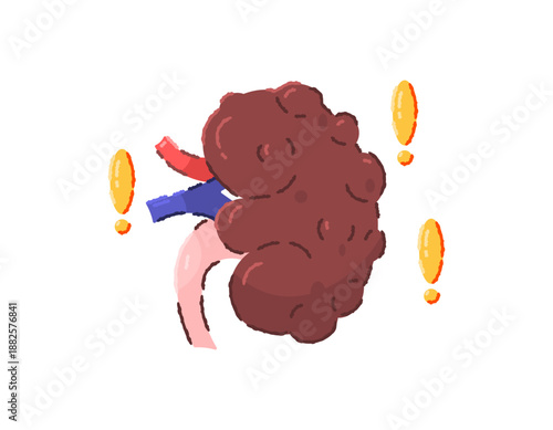 Illustration of an unhealthy kidney organ. Awareness of kidney diseases and issues. Infection, cancer, tumor. Kidney lump and brown. Organ health problems. Flat style outline crayon. White background.
