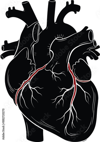 Black silhouette of a human heart with red and white coronary arteries