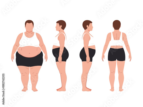 Infographic illustration of woman in underwear showing weight loss stages