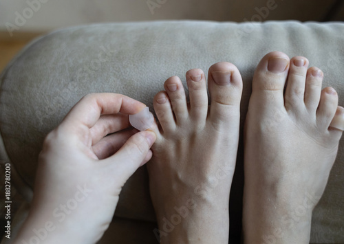 Silicone toe sleeve or cap. Woman puts on protective cover on little toe. Fights corns, prevents blisters and ingrown toenails