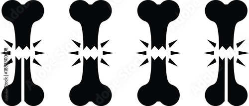 Fractured bone vector icon graphic set representing osteoporosis or bone injury in minimalist black and white medical illustration for healthcare advertising and orthopedic presentations showing fragi