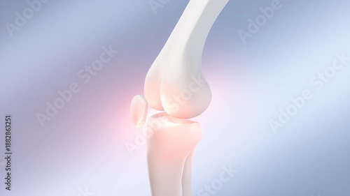 The human knee bone, with painful points highlighted in red, indicates osteoarthritis.