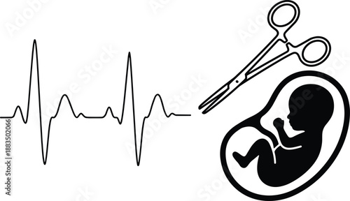 Medical abortion concept illustration showing fetus silhouette, surgical scissors and heartbeat line, reproductive health, pregnancy choice, ethics debate, healthcare awareness, black 