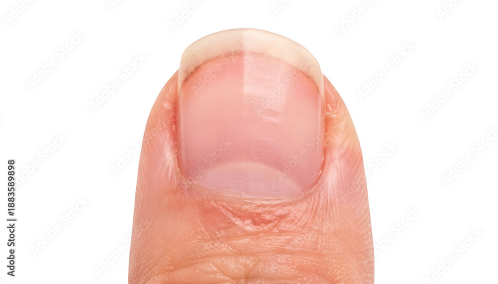 Fototapeta premium Closeup photo of a single fingernail showing gradual thickening and curvature isolated on white background highlighting natural nail growth changes over time.