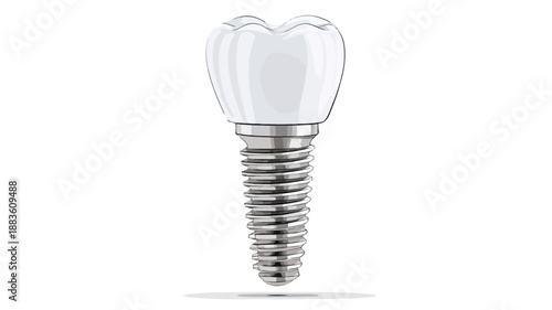 Precision Dental Screw Design Vector Art and Illustration