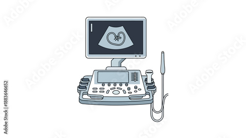 Ultrasound Machine with Monitor and Transducer.