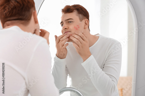 Teenage boy with acne squis...
