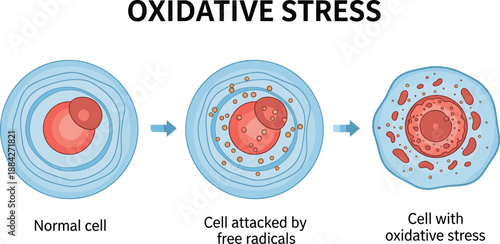 Oxidative stress cell stages, free radical damage, normal to inflamed cell anatomy, medical health concept – flat vector illustration