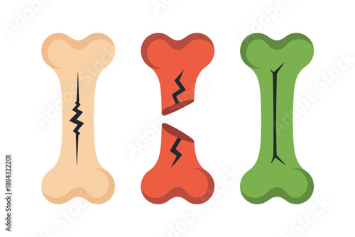 Cartoon bones with cracks and breaks in different colors and styles illustration