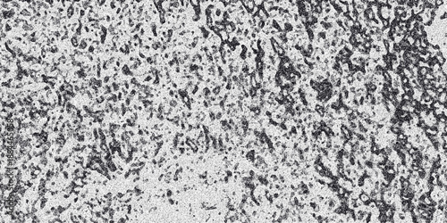 Detailed monochrome textured surface with a dense, irregular pattern of dark splotches and granular noise, creating a rough and organic feel