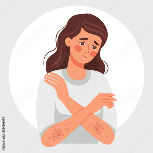 Sad woman suffering from skin rash. Allergic itching, skin inflammation, redness and irritation. Healthcare and medicine illustration.