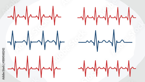 Set of electrocardiogram heart rate lines in red and blue colors representing pulse rhythm and medical monitoring.