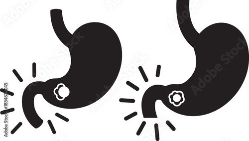 Stomach illness silhouette with tumor and inflammation
