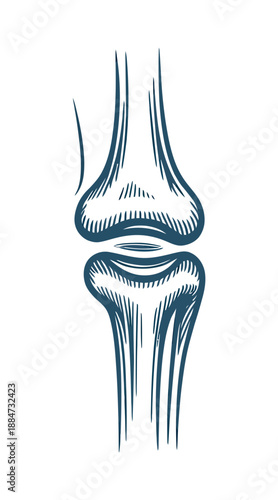 An illustration of a human knee joint in a medical context