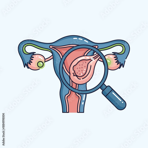 Female reproductive system illustration with magnifying glass examining uterus and ovaries