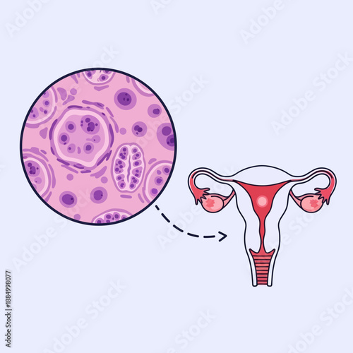 Uterus Anatomy and Histology: Fibroids and Endometrial Cells Illustration