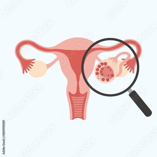 Female reproductive system diagram with ovary magnified showing follicles