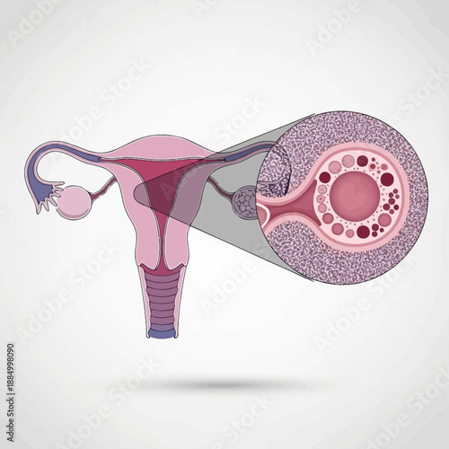 Female reproductive system illustration with magnified ovary showing follicles
