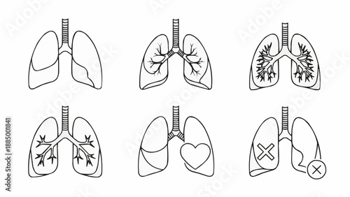 Set of human lungs illustrations showing different conditions and health states.