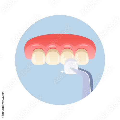 Veneer installation vector isolated on white background.