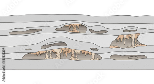 Geological cross-section diagram illustrating dissolution features and irregular voids within layered sedimentary rock formations.