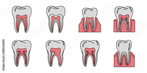Dental anatomy illustration tooth cross sections on black background