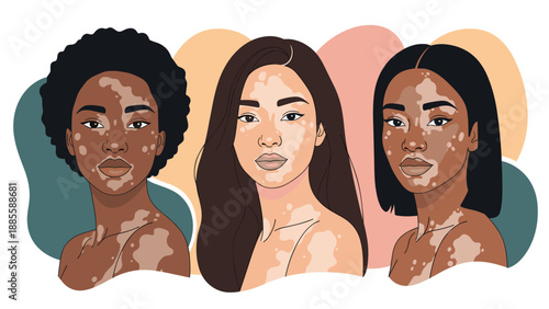 Three diverse women with vitiligo are depicted in a flat illustration style against a backdrop of soft abstract shapes and warm tones.