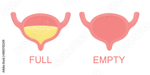 Vector illustration of urinary bladder full and empty isolated on white background. Simple medical illustration for healthcare, clinic, education, infographic and medical design projects.