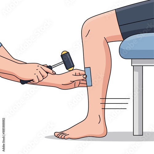Essential neurological reflex test being performed by doctor with hammer