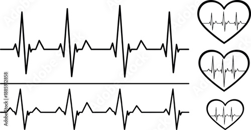 Electrocardiogram waveform comparison, heart rhythm monitoring, medical diagnostic illustration, cardiology concept, healthcare technology, ECG signal analysis, heartbeat pattern, clinical data visual