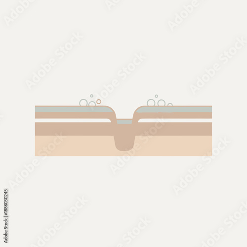 Abstract Illustration Of Epidermal Layer With Open Pore And Cleansing Bubbles Concept