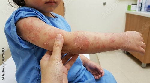 Pediatric patient with severe skin rash being examined by doctor