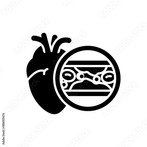 Atherosclerosis related to metabolic syndrome medical concept