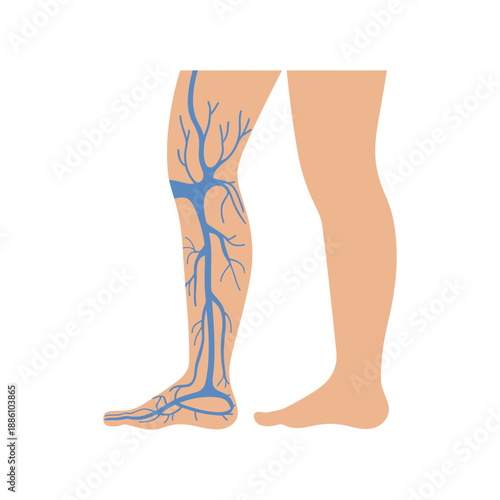 Human legs show blue circulatory system veins illustrating poor blood flow.