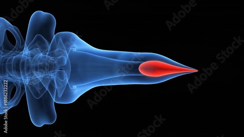 Microscopic anatomy of a nematocyst stinging cell showing the red stylet and blue capsule structure.
