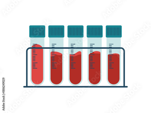Blood samples in test tubes for medical testing