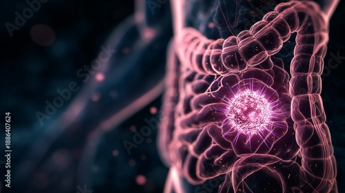 3D inside of a human body, one cancer small cell is visible in the large intestine