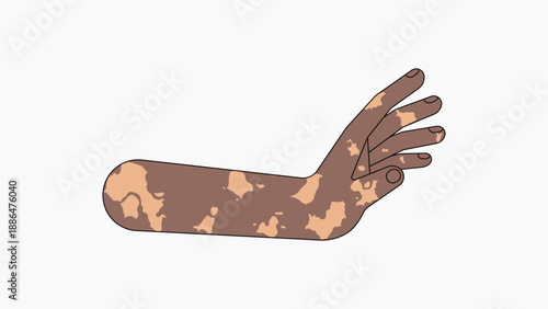 Vitiligo palm hand, gesture flat collage element vector