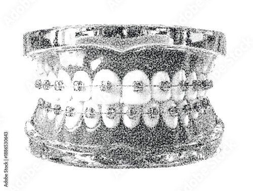 Halftone art collage cut outs set of dental braces on teeth vector illustration vintage style for dental clinic or orthodontic design