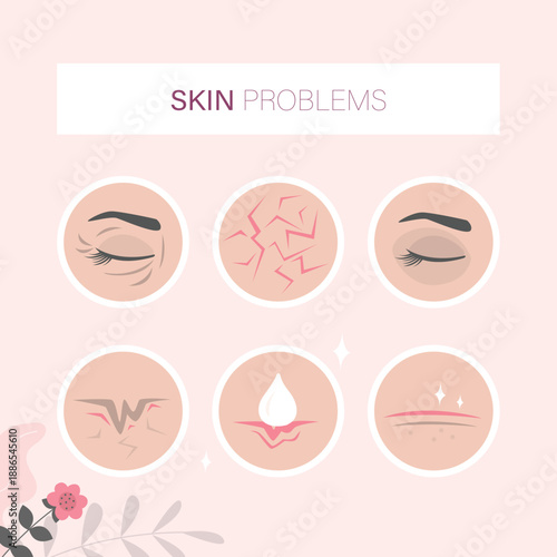 Human face skin problems. Acne and pimples, black spots, redness, dryness, circles under the eyes and wrinkles. Infographic banner for cosmetic brochure or banner, poster.