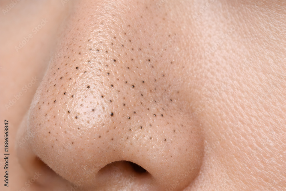 Fototapeta premium Close-up of Blackheads on Nose Skin Texture