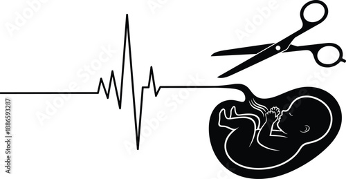 Heartbeat line with scissors and unborn baby silhouette isolated on white background representing abortion concept, pregnancy decision, medical ethics and reproductive health symbolism