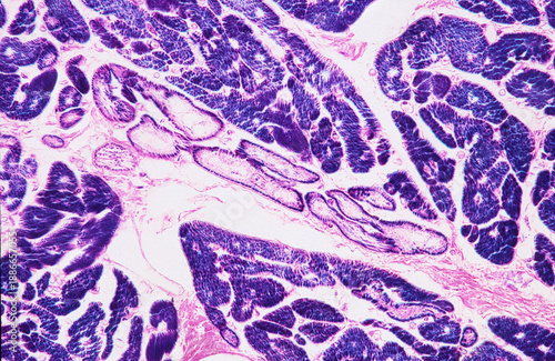 Human heart. Purkinje fibres