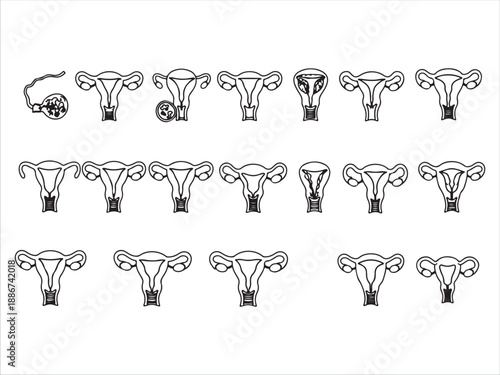 Series of Uterus Illustrations for Medical and Educational Use