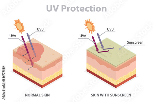 UV skin protection concept. The difference between skin without sunscreen lotion and skin with sun protection lotion. UVA and UVB of skin damage. Flat isometric vector banner on white background.