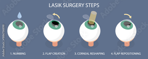 Lasik eye surgery steps procedure (numbing, flap creation, corneal reshaping, flap repositioning). 3d flat isometric vector illustration on dark background.